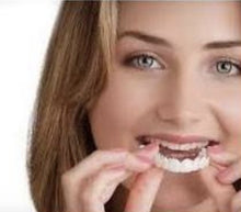 Load image into Gallery viewer, Simulation Whitening Lower Row Braces Teeth Whitening Kit Upper Row Dentures Braces +