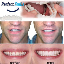 Load image into Gallery viewer, Simulation Whitening Lower Row Braces Teeth Whitening Kit Upper Row Dentures Braces +