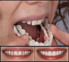 Load image into Gallery viewer, Simulation Whitening Lower Row Braces Teeth Whitening Kit Upper Row Dentures Braces +