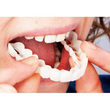 Load image into Gallery viewer, Simulation Whitening Lower Row Braces Teeth Whitening Kit Upper Row Dentures Braces +
