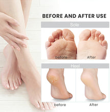 Load image into Gallery viewer, Waterproof Magnetic Rechargeable Electric Foot Grinder Pedicure Tool +