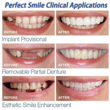 Load image into Gallery viewer, Simulation Whitening Lower Row Braces Teeth Whitening Kit Upper Row Dentures Braces +
